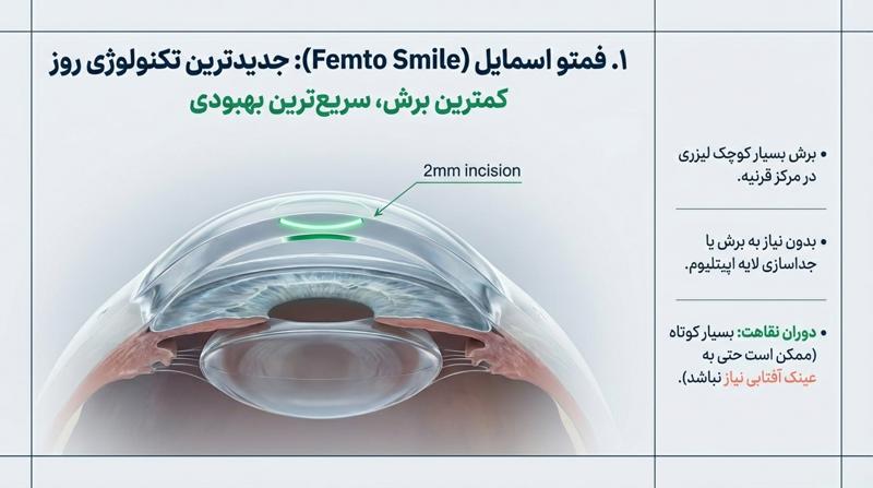 جدیدترین عمل چشم، فمتو اسمایل